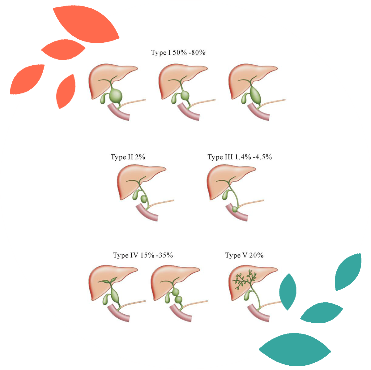 choledochal cyst surgeon in delhi noida