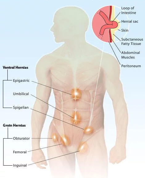 mimimal invasive laparoscopic surgery