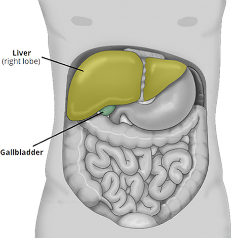 gall stone laparoscopic surgery in delhi noida