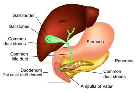 cbd stone treatment in delhi noida