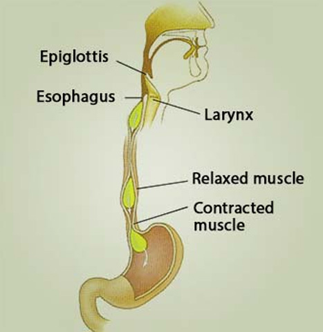 achalasia cardia surgery in delhi