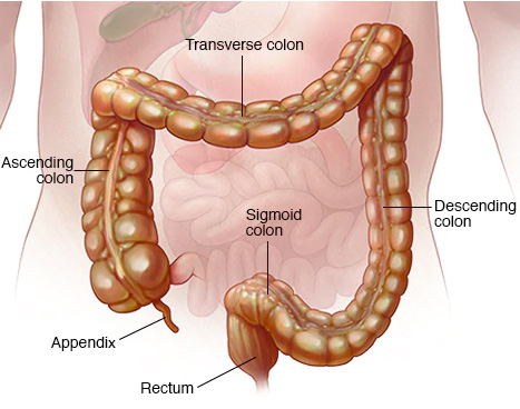 crohns disease symptoms treatment in delhi noida